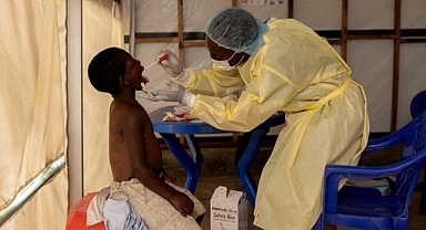 Demokratik Kongo Cumhuriyeti, Maymun Çiçeği Varyantının Yayılması Nedeniyle Acil Durum İlan Ediyor