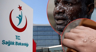 Sağlık Bakanlığı, Maymun Çiçeği Hastalığına Yönelik Güncellenmiş Rehberi Yayımladı