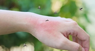 Sivrisineklerin İnsanları Çekme Nedenleri ve Korunma Yolları