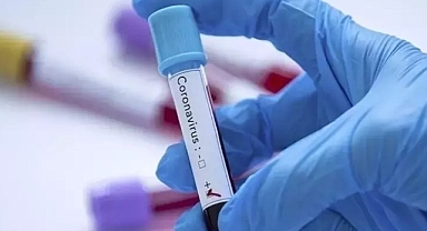 COVID-19'un Kaynağı: Yeni Araştırmalar Pazar Bağlantısını Güçlendiriyor