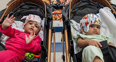 Türkiye’de İlk Kez Kafadan Yapışık İkizler Başarılı Bir Operasyonla Ayrıldı