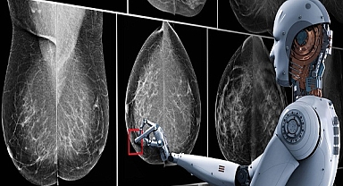 Yapay zekâya güvenin acı faturası: Geç teşhis edilen kanser